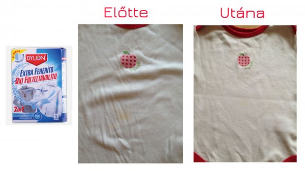 Színfogó extra fehérítő előtte-utána