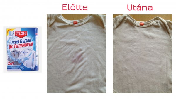 Színfogó extra fehérítő előtte-utána