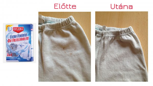 Színfogó extra fehérítő előtte-utána