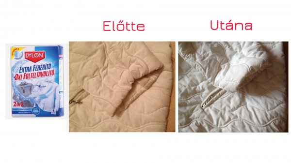 Színfogó extra fehérítő előtte-utána